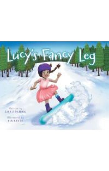 Lucy's Fancy Leg