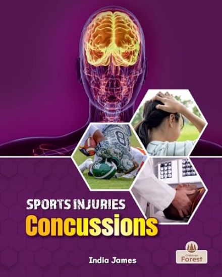 Concussions