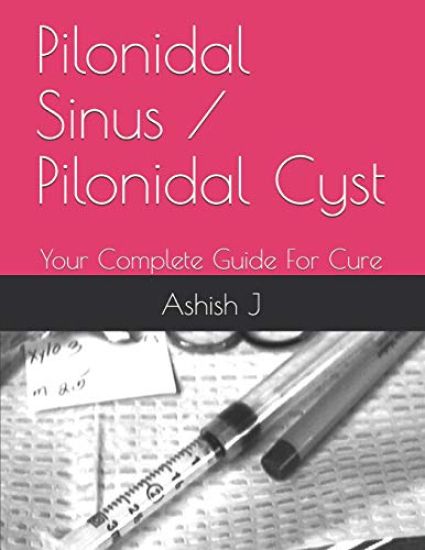 Pilonidal Sinus / Pilonidal Cyst: Your Complete Guide For Cure