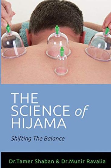 The science of hijama
