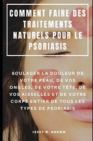Comment Faire Des Traitements Naturels Pour Le Psoriasis: Soulager La Douleur de Votre Peau, De Vos Ongles, de Votre Tête, De Vos Aisselles Et de Votr