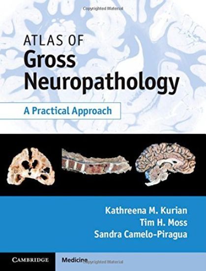 Atlas of Gross Neuropathology Book and Online Bundle