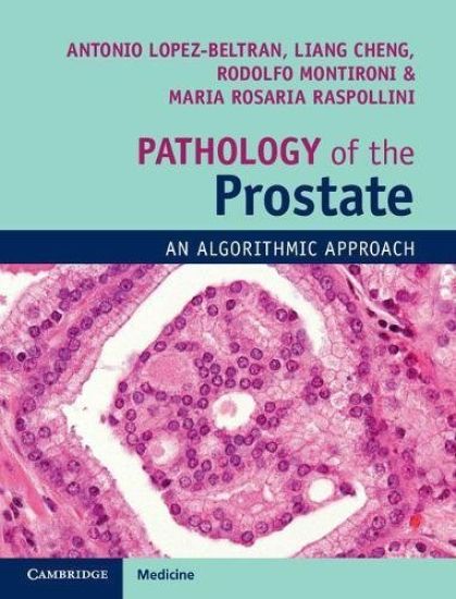 Pathology of the Prostate
