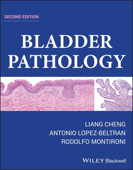 Bladder Pathology