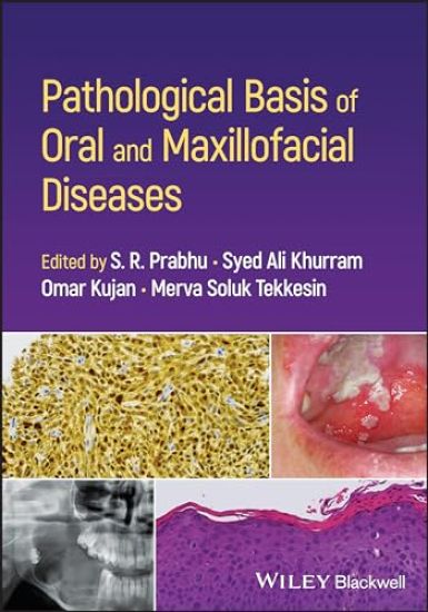 Pathological Basis of Oral and Maxillofacial Diseases