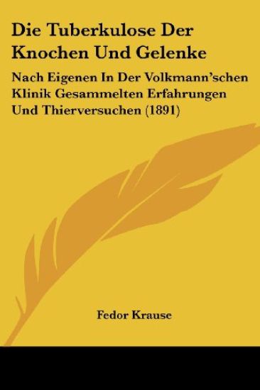 Krause, F: Tuberkulose Der Knochen Und Gelenke