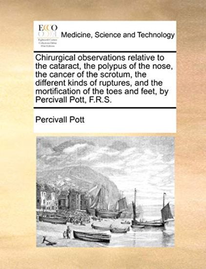 Chirurgical Observations Relative to the Cataract, the Polypus of the Nose, the Cancer of the Scrotum, the Different Kinds of Ruptures, and the Mortification of the Toes and Feet, by Percivall Pott, F.R.S.