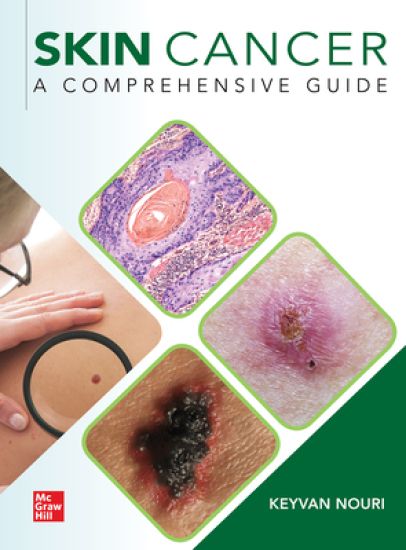 Kansikuva: Skin Cancer: A Comprehensive Guide