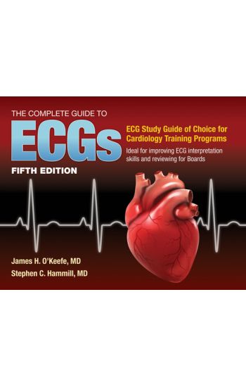 The Complete Guide to ECGs: A Comprehensive Study Guide to Improve ECG Interpretation Skills