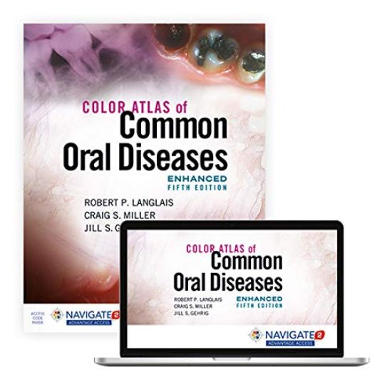 Color Atlas of Common Oral Diseases