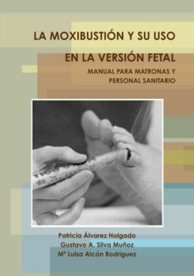 LA Moxibustion Y Su USO En La Version Fetal. Manual Para Matronas Y Personal Sanitario.