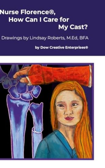 Nurse Florence(R), How Can I Care for My Cast?