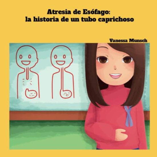Atresia de Esófago