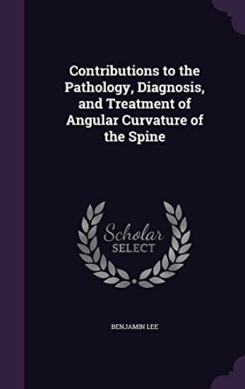 Contributions to the Pathology, Diagnosis, and Treatment of Angular Curvature of the Spine