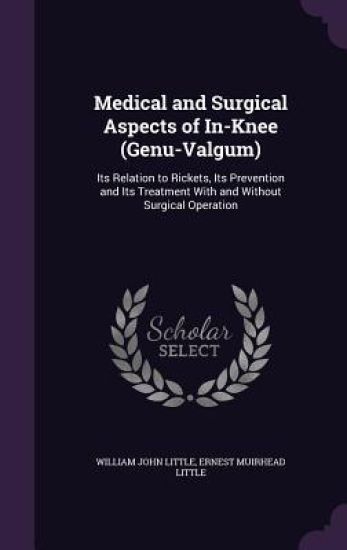 Medical and Surgical Aspects of In-Knee (Genu-Valgum)