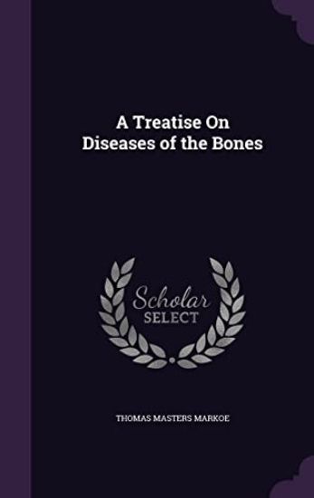 A Treatise on Diseases of the Bones