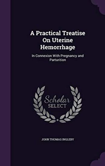 A Practical Treatise on Uterine Hemorrhage
