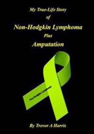 My True-Life Story of Non-Hodgkin Lymphoma Plus Amputation