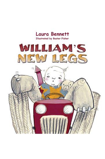William's New Legs