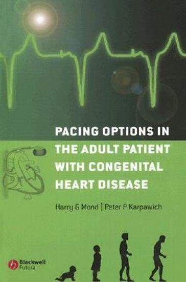 Pacing Options in the Adult Patient with Congenital Heart Disease