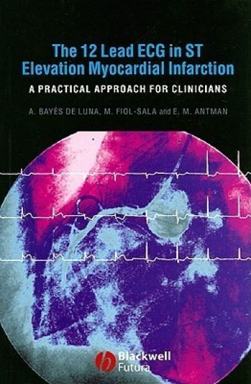 The 12 Lead ECG in ST Elevation Myocardial Infarction
