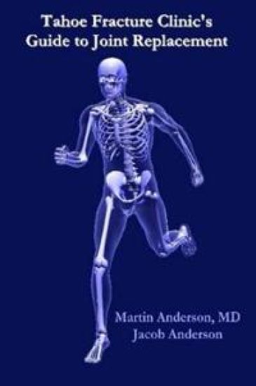 Tahoe Fracture Clinic's Guide to Joint Replacement