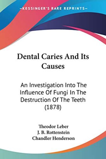 Dental Caries and Its Causes