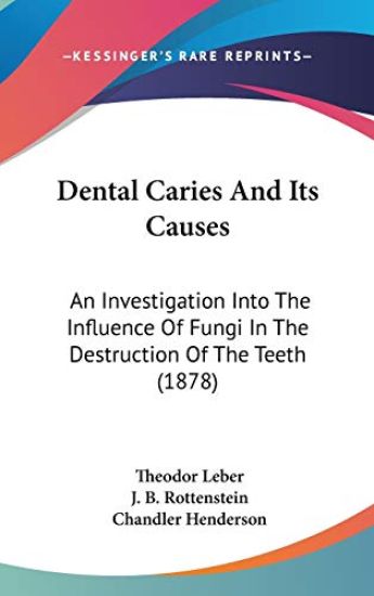 Dental Caries and Its Causes