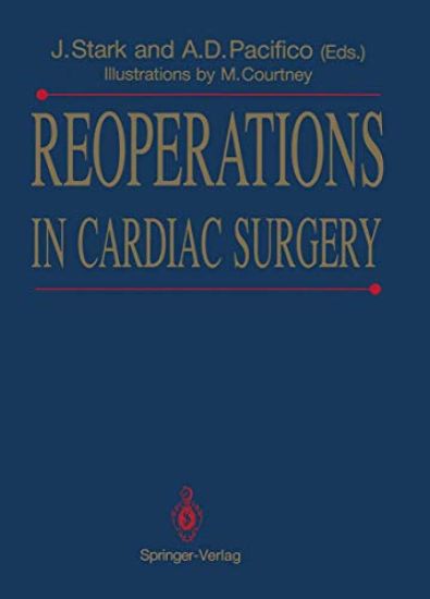 Reoperations in Cardiac Surgery