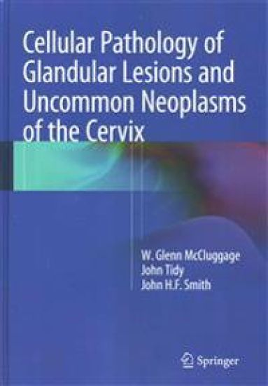 Cellular Pathology of Glandular Lesions and Uncommon Neoplasms of the Cervix