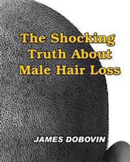 The Shocking Truth About Male Hair Loss: Secrets You Need to Know About Losing Hair So You Can Stop From Going Bald