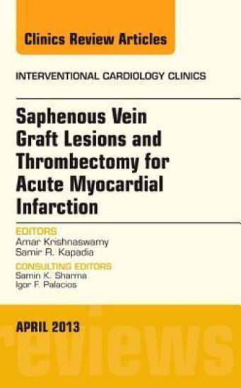 Saphenous Vein Graft Lesions and Thrombectomy for Acute Myocardial Infarction, An Issue of Interventional Cardiology Clinics