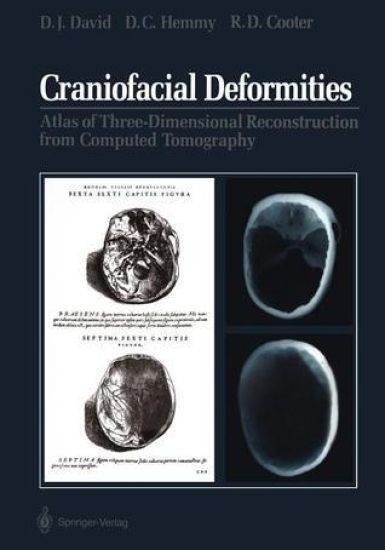 Craniofacial Deformities