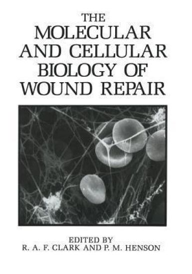 The Molecular and Cellular Biology of Wound Repair