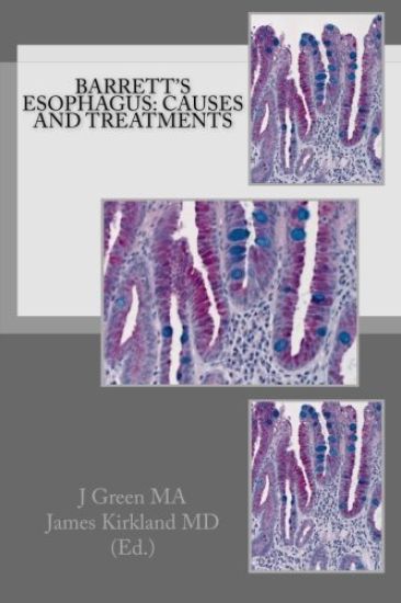 Barrett's Esophagus: Causes and Treatments