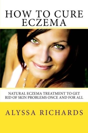 How To Cure Eczema: Natural Eczema Treatment To Get Rid Of Skin Problems Once And For All