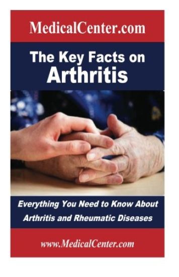 The Key Facts on Arthritis: Everything You Need to Know About Arthritis and Rheumatic Diseases