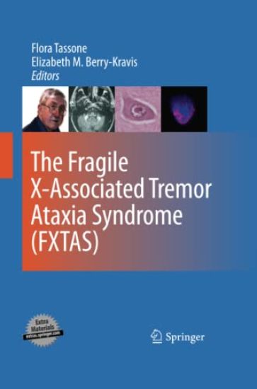 The Fragile X-Associated Tremor Ataxia Syndrome (FXTAS)