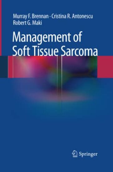 Management of Soft Tissue Sarcoma