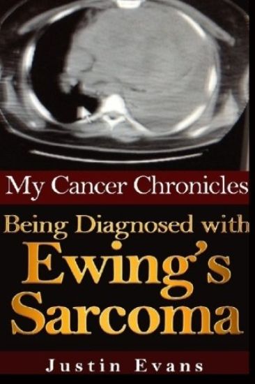 My Cancer Chronicles: Being Diagnosed with Ewing's Sarcoma
