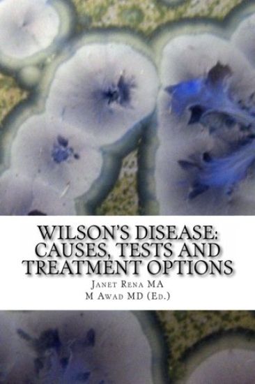 Wilson's Disease: Causes, Tests and Treatment Options