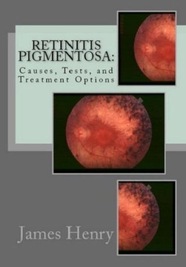 Retinitis Pigmentosa: Causes, Tests, and Treatment Options