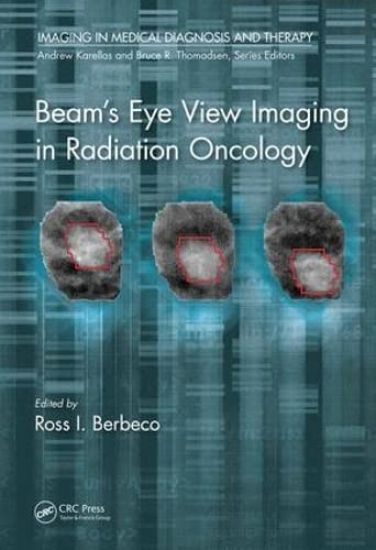 Beam's Eye View Imaging in Radiation Oncology