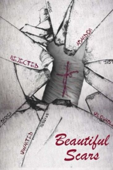 Beautiful Scars: Beautiful Scars: A New Identity Comes in Healing