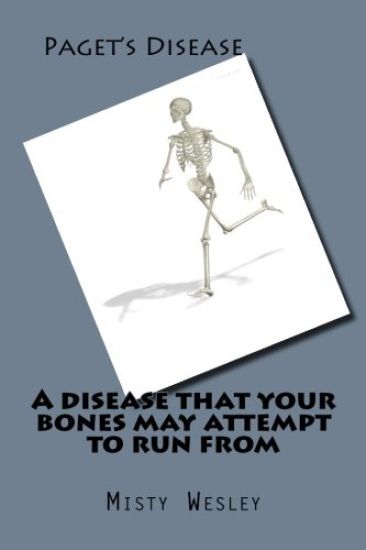 A disease that your bones may attempt to run from