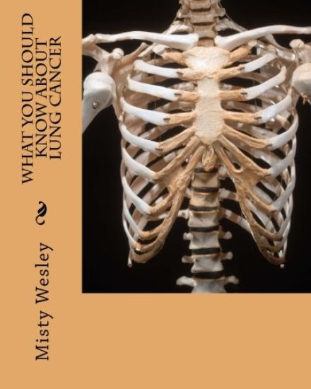 What you should know about Lung Cancer