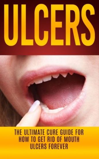 Ulcers: The Ultimate Cure Guide for How to Get Rid of Mouth Ulcers Instantly