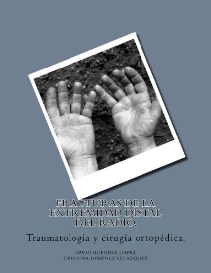 Fracturas de la extremidad distal del radio.