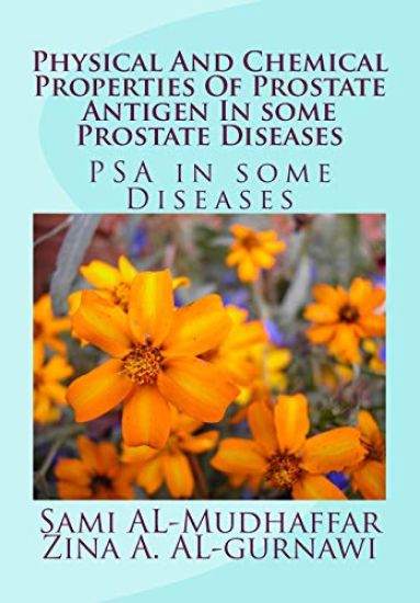 Physical And Chemical Properties Of Prostate Antigen In some Prostate Diseases: PSA in some Diseases