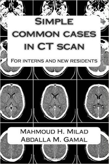 Simple common cases in CT scan: For interns and new residents
